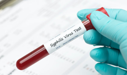 blood sample for hiv test