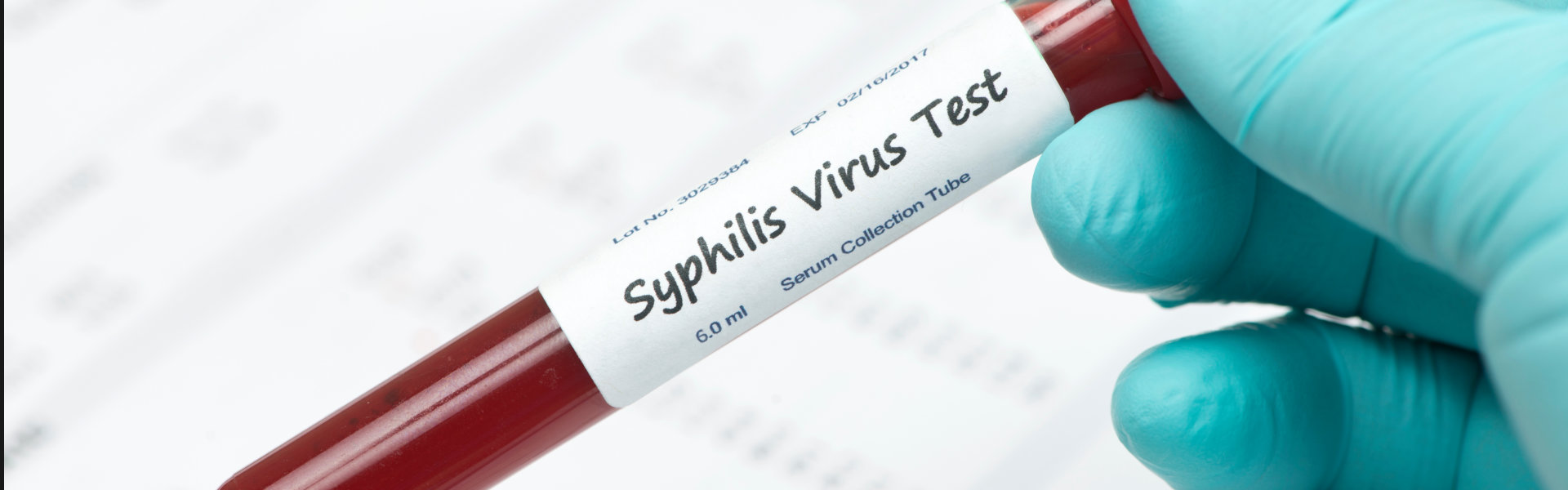 blood sample for syphilis